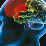 Δεν παρουσιάζουν όλα τα άτομα τον ίδιο τύπο ή μορφή αφασίας