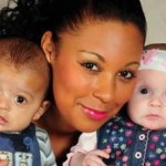 Δίδυμα με διαφορετικό χρώμα δέρματος!