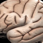 Νέοι τρόποι θεραπείας 130 εγκεφαλικών παθήσεων