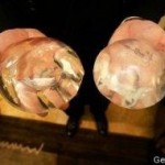 Υποψήφιος στις βουλευτικές εκλογές μοιράζει κουπόνια προσθετικής στήθους!