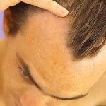 Διατροφή για να μη σας... πέσουν τα μαλλιά