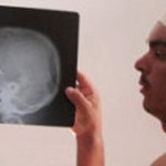 Ζούσε με μαχαίρι στο κεφάλι του για τρία χρόνια