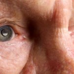 Νέα τεχνολογία κατά της κύριας αιτίας τύφλωσης ηλικιωμένων