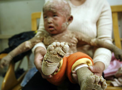 moro_Psari2_small ο μικρός Song Sheng