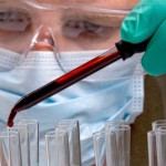 Σύγχρονη μάστιγα οι νεφροπάθειες