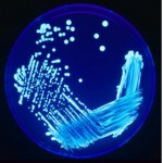 Ένας νεκρός και 22 άτομα με νόσο των λεγεωνάριων στη Μαδρίτη