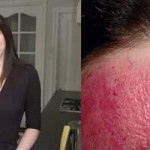 Η γυναίκα που είναι αλλεργική στην τεχνολογία