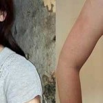 Το κορίτσι που είναι αλλεργικό στο νερό