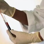 Απλό τεστ θα εντοπίζει τον καρκίνο