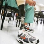 Έκαψαν το τεχνητό του πόδι γιατί έχασε στο στοίχημα για τη μεγαλύτερη κατανάλωση ποτού!