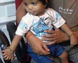 Έσπασε παγκόσμιο ρεκόρ με… 34 δάχτυλα!