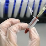 Αιματολογικό τεστ θα αποκαλύπτει πόσα χρόνια θα ζούμε