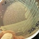 Το βακτήριο EHEC προκάλεσε άλλον έναν θάνατο στη Γερμανία