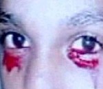 Δάκρυα αίματος!