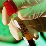 Παγκόσμια Ημέρα κατά της Ηπατίτιδας