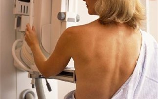 Πόσο επικίνδυνη είναι η ακτινοβολία της μαστογραφίας;