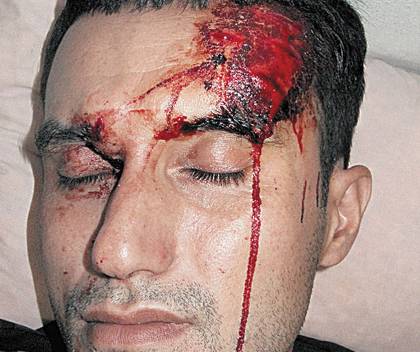 Μπαράζ ρατσιστικών επιθέσεων