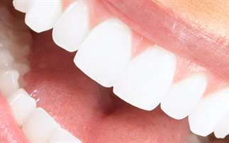 Όσα πρέπει να ξέρετε για τη λεύκανση δοντιών