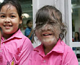 Το πιο τριχωτό κορίτσι στον κόσμο!