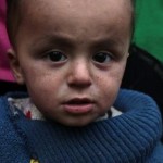 Πολιομυελίτιδα σε Χαλέπι και Δαμασκό