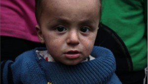 Πολιομυελίτιδα σε Χαλέπι και Δαμασκό